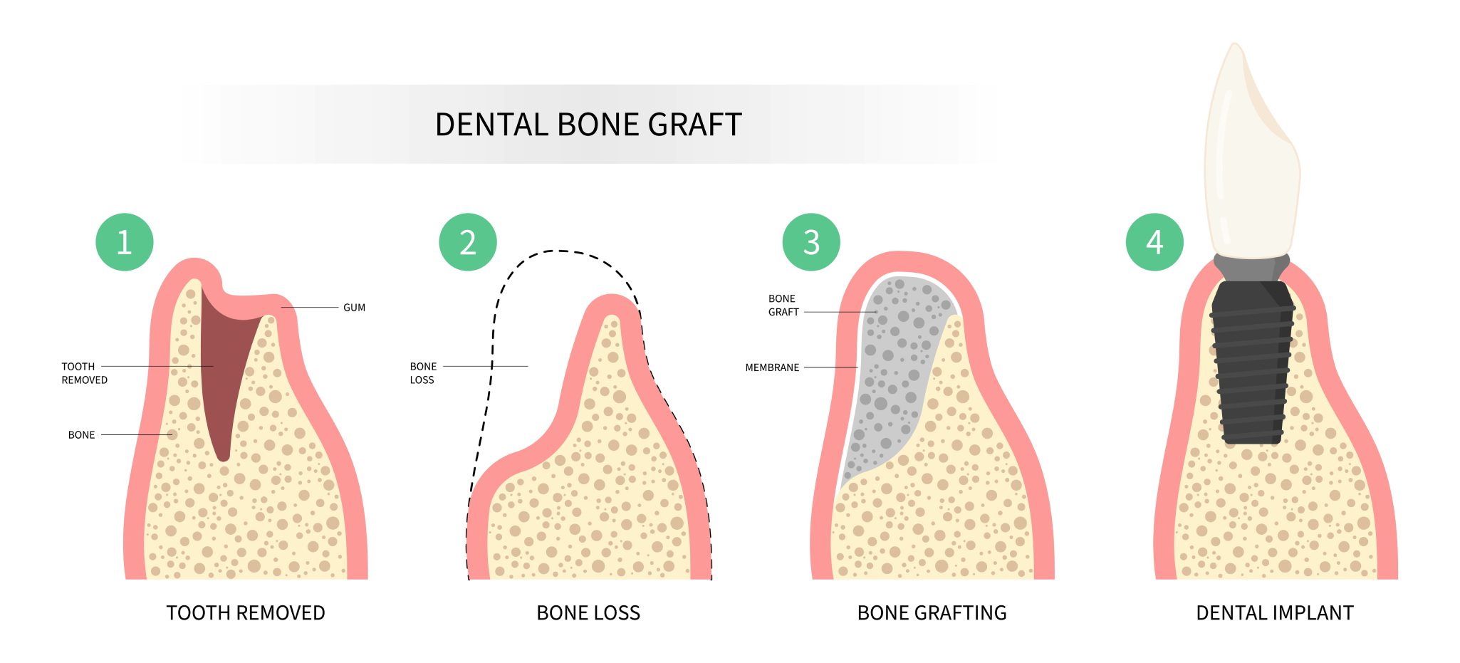 Rocky Mountain Oral Surgery & Implant Center -